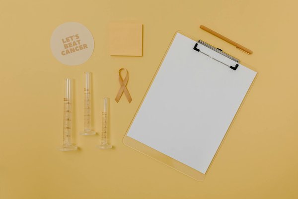 Maximisez vos gains : stratégie de publication de liens 2024-2025 !