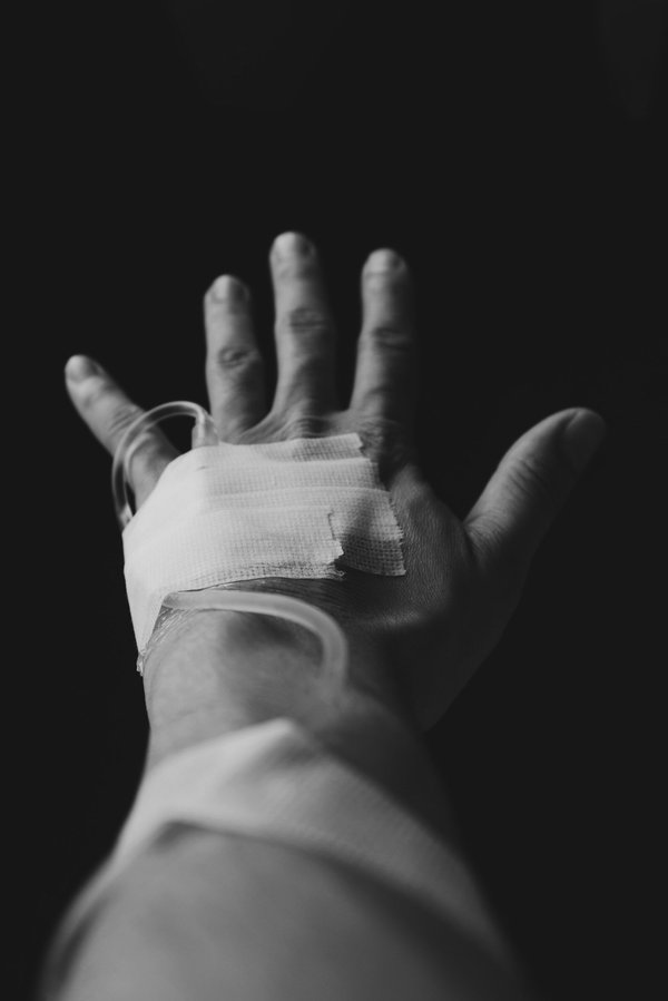 Soulagement pour les paupières tombantes à marseille : découvrez les solutions